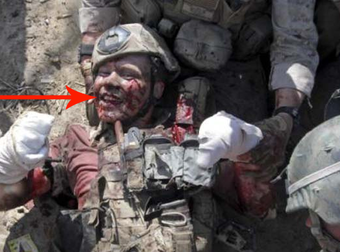 This Marine Has Smiled His Entire Life. Yes, Even When His Limbs Were Blown Off.