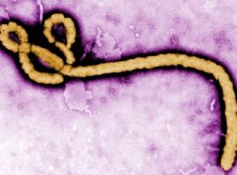 Think You Know The Truth About The Ebola Virus? Think Again.