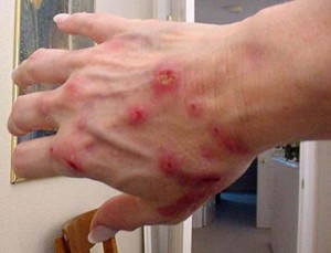 No One Knows Why These 10 Diseases Exist… Which Makes Them Even More Terrifying.