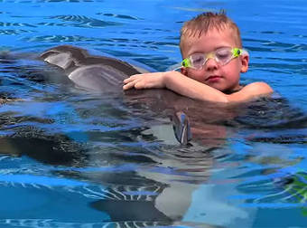 Boy With Prosthetic Flippers Swims With a Dolphin With A Prosthetic Tail.