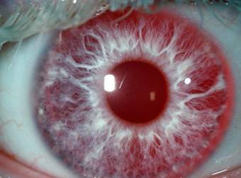 These Freaky Facts About Your Own Eyes Are True, But Eye Can’t Believe It.