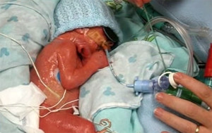 This Baby Was Pronounced Dead By Doctors. Then As Mommy Was Saying Goodbye… WOW.