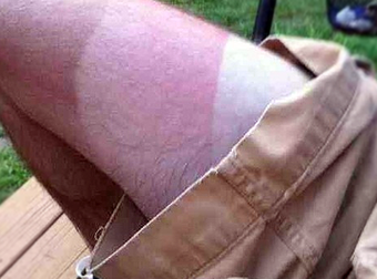 Check Out These Hilarious 27 Summer Fails. OUCH.