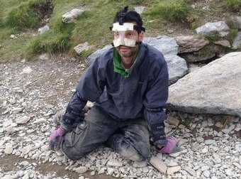 Man Pushes Brussels Sprout Up A Mountain With His Face For Charity.