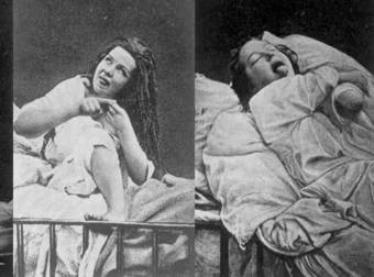 Doctors Used To Perform These Insane Procedures On Patients. Were THEY Insane?