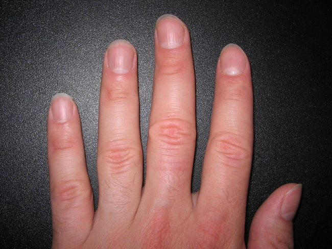 9. Each finger and toenail takes six months to grow from base to tip.