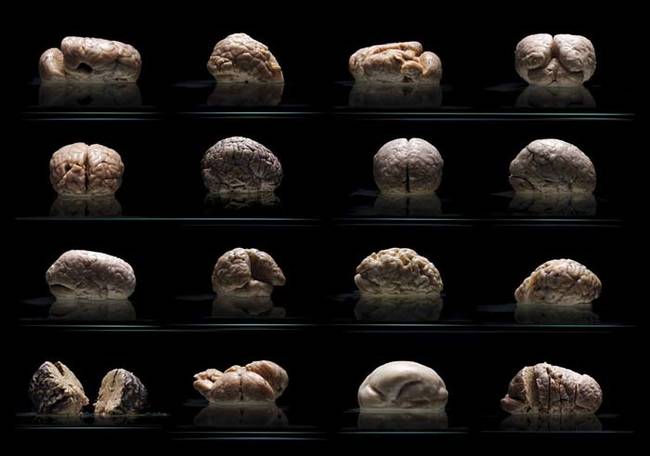 The University of Texas at Austin is now having the entire collection of brains undergo MRI scans so that they can be taught to students at the university's new medical school.