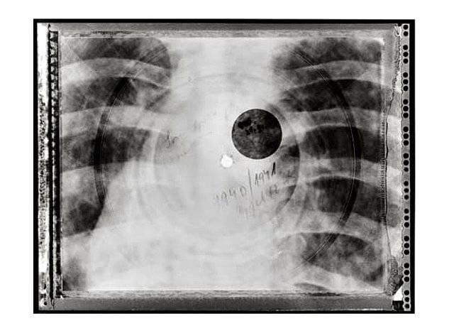 The hole for the center pin would be burned in with a cigarette, and then the square X-ray would be trimmed into a circle with scissors.