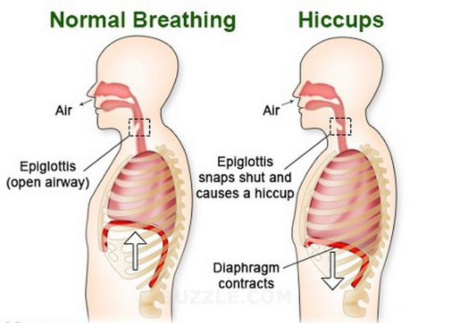 Hiccuping.