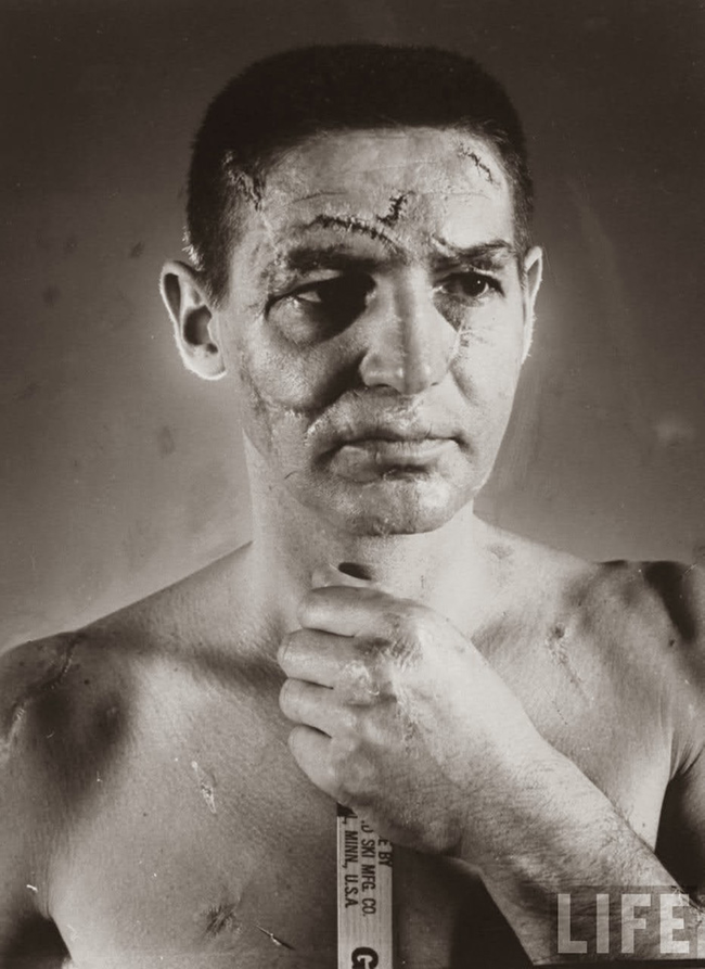 10.) Portrait of hockey goalie Terry Sawchuk before face masks became standard in 1966.