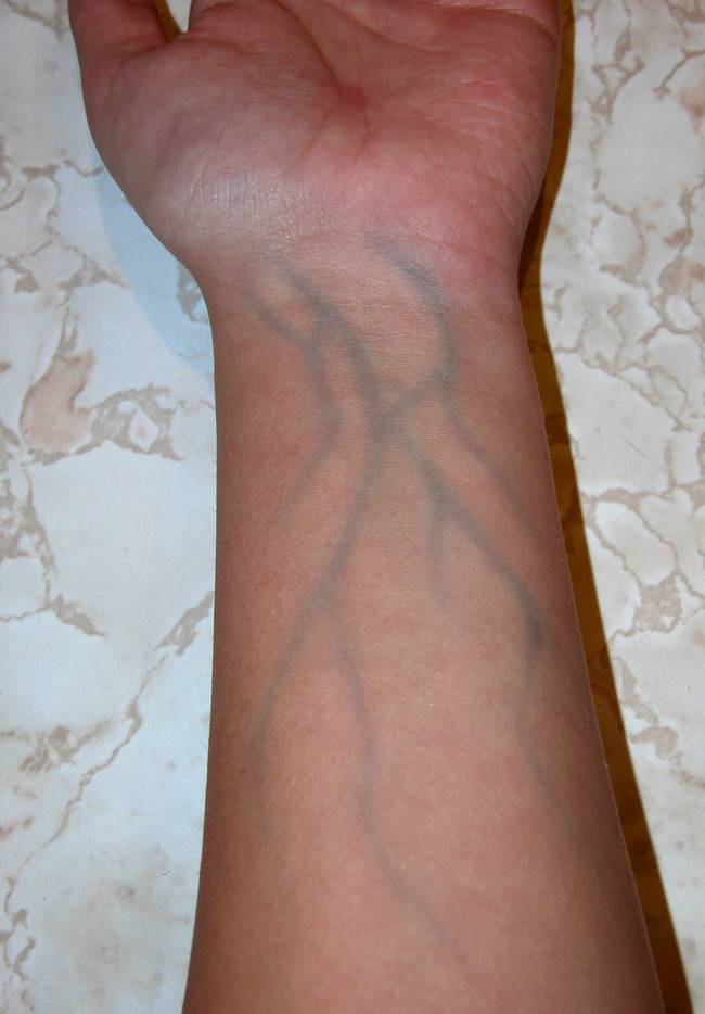 Blue veins: Human blood in veins is not blue. Blood is always red due to hemoglobin, our veins just appear to be blue.