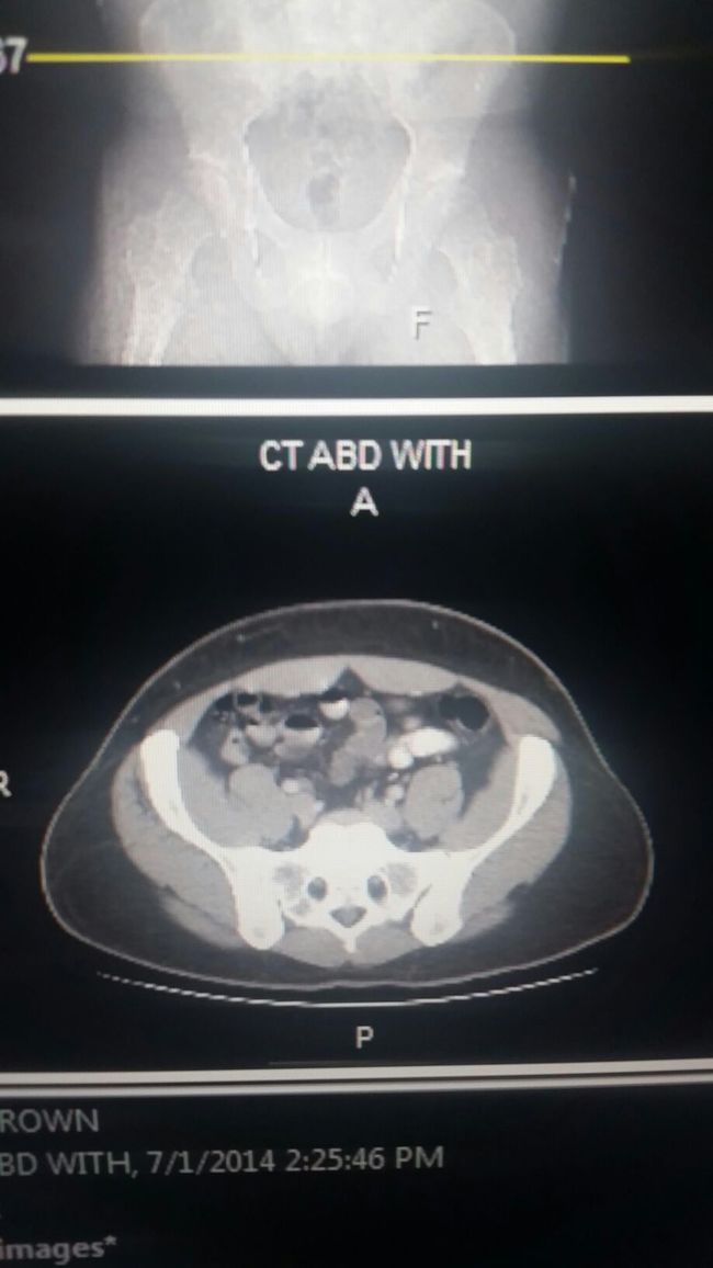 8. This pelvis looks like Pikachu.