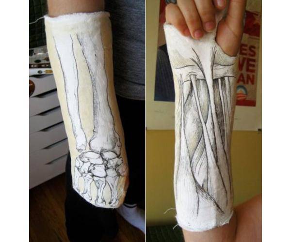 This cast blends anatomical studies with an artsy twist.