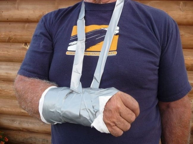 20.) Duct Tape Soft Cast