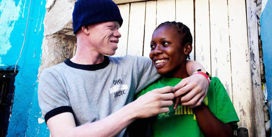 In Tanzania, 1 in 1,400 people have albino skin. In the West, the numbers are 1 in 20,000.