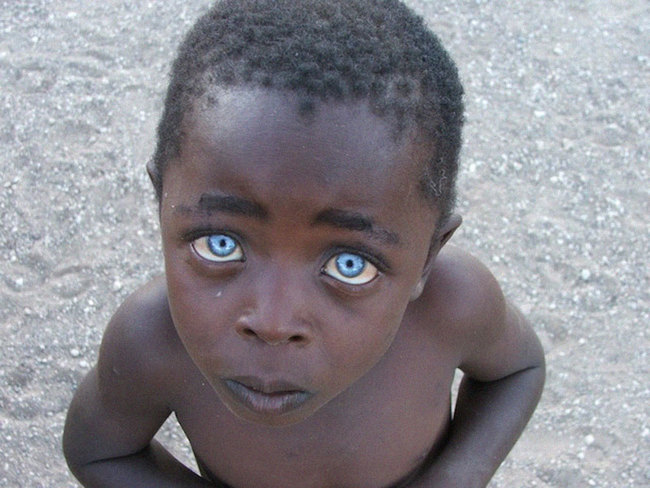 16. Innocence - This photo is real. The blue eyes and dark skin probably represents Ocular Albinism or Juvenile uveitis. Both conditions cause the pigment of the iris to be less dense.