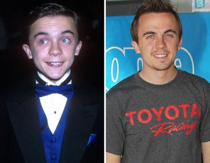 10.) Frankie Muniz - 2000 and now.