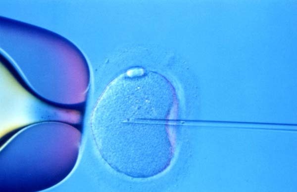 1.) Nancy Andrews of Commack, NY, became pregnant after receiving in vitro fertilization at a clinic. However, when the child was born, they instantly realized that they must have had a DNA switch-up. Their daughter had much darker skin than they expected. The doctors accidentally used another man’s sperm.