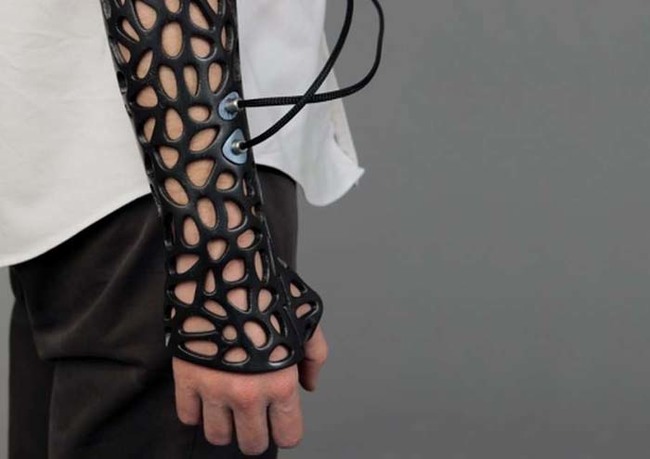 27.) This 3D printed cast with ultrasound technology helps bones heal 40% faster.