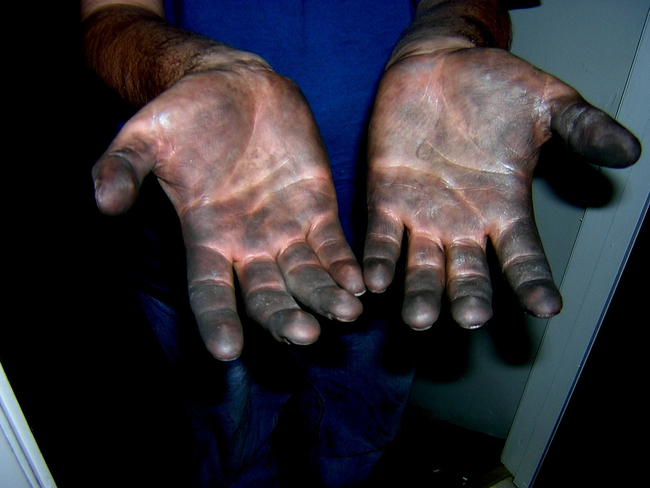 7.) Law of Manual Labor – When your hands are covered in grease, your nose will begin to itch, you'll need something from your pocket, and you’ll have to pee real bad.