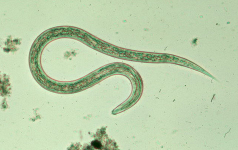 Hookworm - These vampiric creatures live in your intestines and feast on your blood, which can cause an iron deficiency.