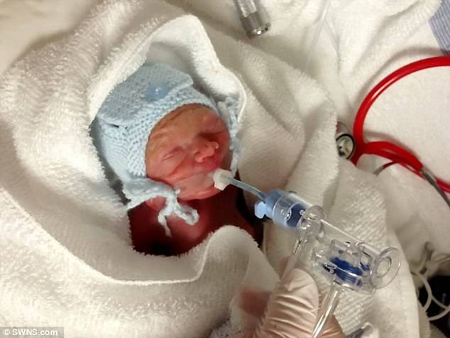 After his birth, Jett suffered from chronic lung disease and jaundice. He also had two holes in his heart.