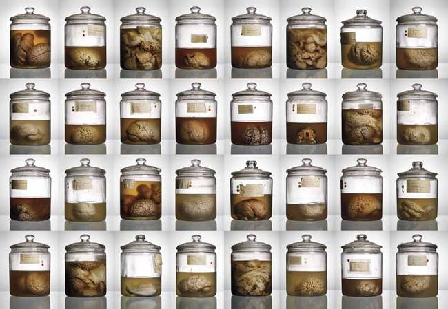 From their research, we now know that this extensive collection of rare human brains was the subject of a bitter fight between the University of Texas and other rival colleges (including Harvard). Ultimately, the University of Texas won, and the collection came to them.