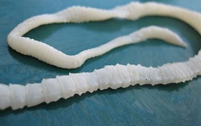 After the tapeworm was discovered on a brain scan, it was quickly removed. It's suspected that the worm hitched a ride on infected meat or through water.