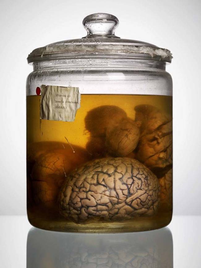 When Voorhes found the brains, they were all tucked into a seemingly forgotten storage closet inside the University of Texas State Mental Hospital.