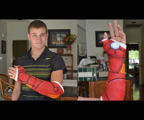 If your broken bone has you feeling less powerful, try channeling a favorite superhero...