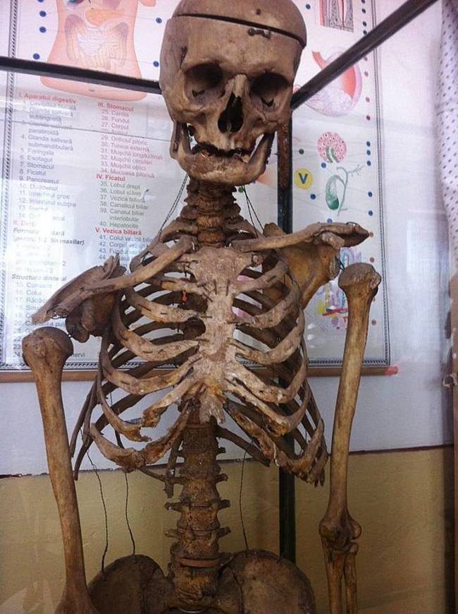 Alexandru Grigore Popescu’s bones are displayed in the rural Puchenii Mosneni elementary school in southeastern Romania’s Prahova county since the late 1960s. Although it wasn't originally known, after a government inspection of the bones, it was allowed to stay in the same classroom where he taught for 50 years.