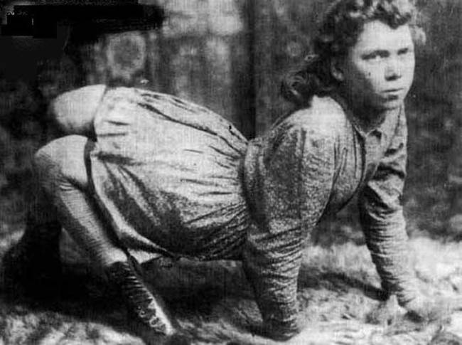 During her life she worked as a circus performer, earning an impressive $200 a week. She lived from 1870 to 1921.