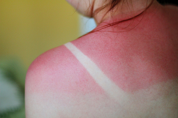 15.) Not Wearing Sunscreen - Think of it as putting on “regretblock.”