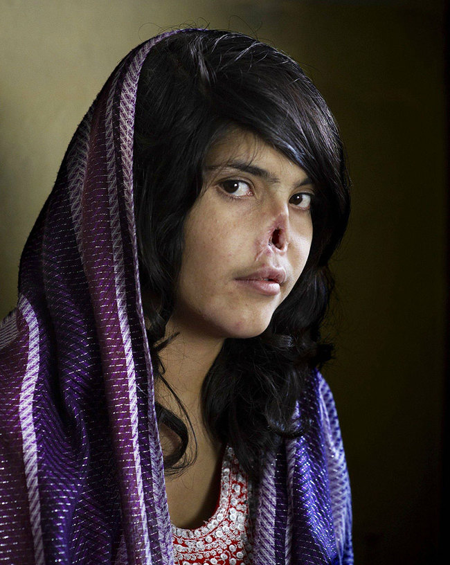 2. Courage - Left for dead after her Taliban father sold her into marriage, and even returned her to her husband after severe abuse and the removal of her nose and ears.