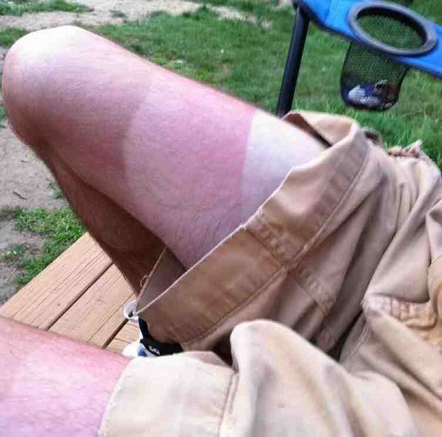 9. This guy with neapolitan tan lines.