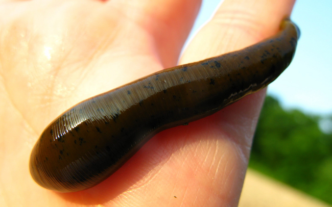 10.) Leeching: Another method of getting rid of those pesky "humors", leeches are still used today to get rid of blood clots.