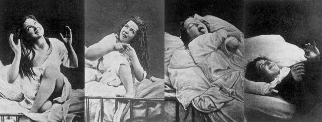 Female Hysteria Treatment.