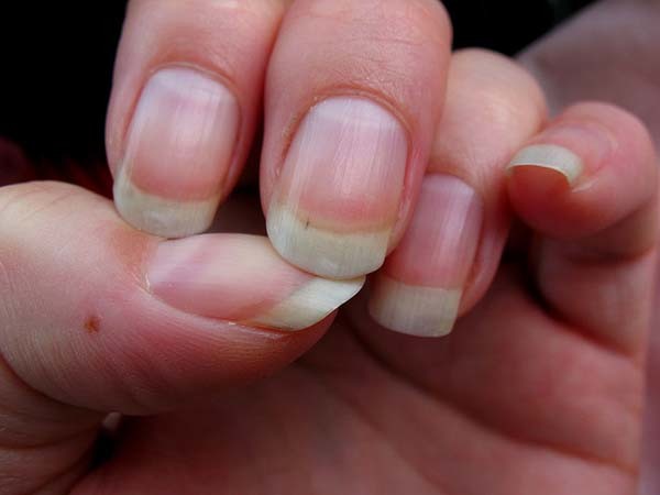 6.) Fingernails and hair continue to grow after you die: When a person died and is buried, skin and muscles shrink during the decaying process. That gives the illusion/appearance of nail and hair growth. However, nothing is actually growing.