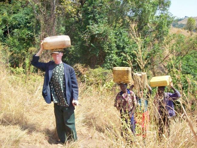 Albinism is a hereditary condition that causes the absence of pigment in the skin, hair, and eyes. Experts say the genetic trend is often linked to inbreeding.