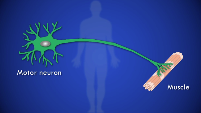 The nerve cells that ALS attacks are the lower motor neurons which carry about a wide range of functions such as moving the limbs, swallowing, and breathing. It doesn't affect the brain, just the motor neurons, so cognitive functions usually remain normal.