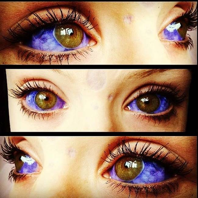 This girl's eyes are actually beautiful.