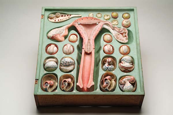 21.) Dr. Louis Auzoux’s paper mache gynecological model from 1880.