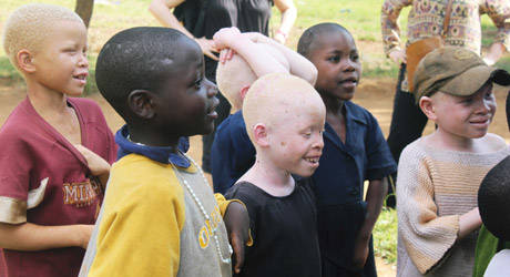 Sometimes, it's the parents of albino children that mutilate these innocents in exchange for money.