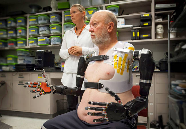 After a surgical procedure, the prosthetic arms are actually connected to Baugh's nervous system, meaning he can move his arms by thought alone--just like any other limb.