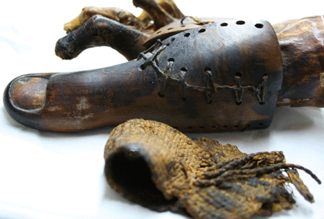 8.) Oldest Prosthetic Limb.