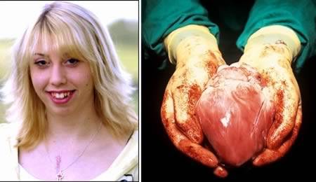 5.) Girl has three transplanted hearts.