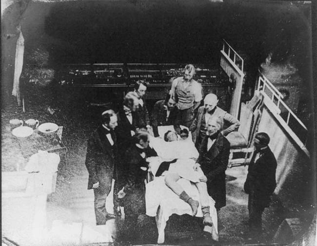 Due to the lack of anesthesia, surgeons had to work fast. Amputation procedures sometimes lasted as little as 30 seconds.