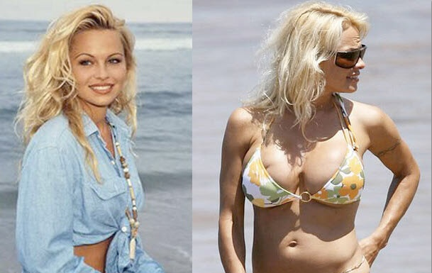 16.) Pamela Anderson has certainly...increased.