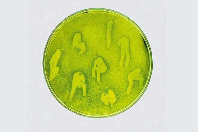 To create each image, Lia immerses the algae in a Petri dish filled with chemicals.