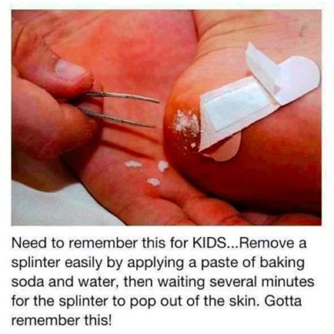 Apply a paste of baking soda and water to a splinter. After a few minutes, the splinter will be easy to remove.